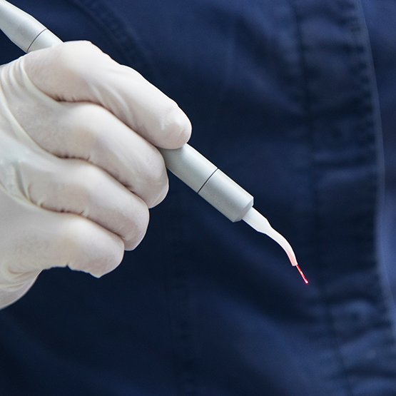 Dentist holding a pen like dental laser device